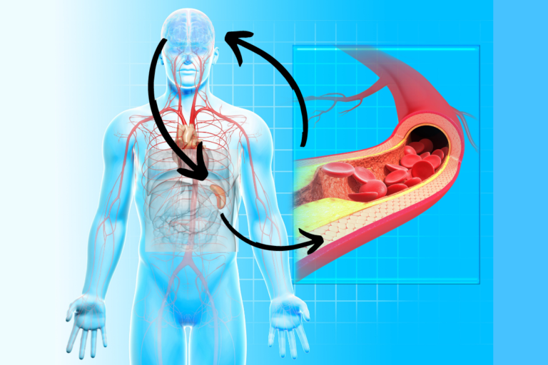 artery-brain-circuit-aterosclerosi